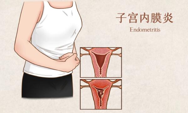 子宫内膜炎能要孩子吗？子宫内膜炎可以怀孕吗