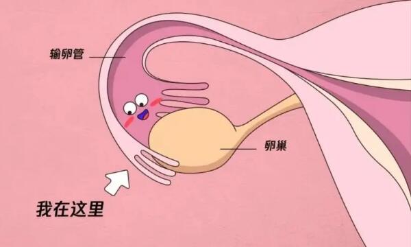 卵巢粘连输卵管也会粘连吗？输卵管粘连分几种